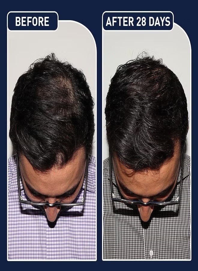 فيج بخاخ نمو الشعر 50 مل - Image 5