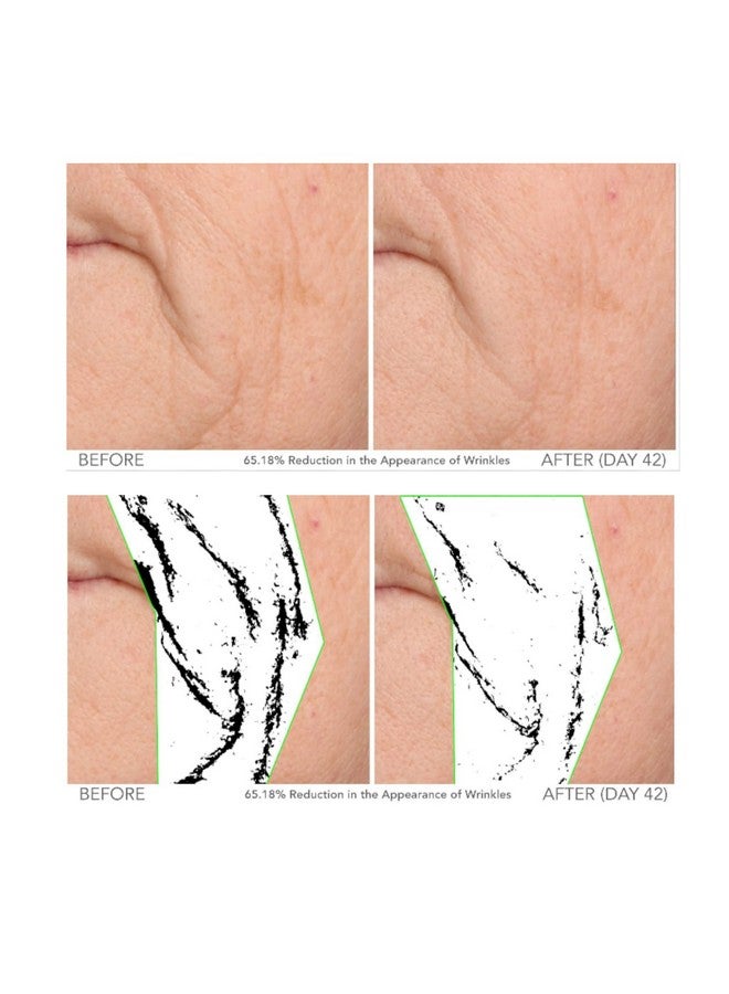 Serious Skincare Serious Beyond Facial Treatment Set Intensive Morning 1 Oz. And Evening 1 Oz. Serums Visibly Improves Fine Lines Wrinkles And Skin Texture On The Face And Neck - Image 4