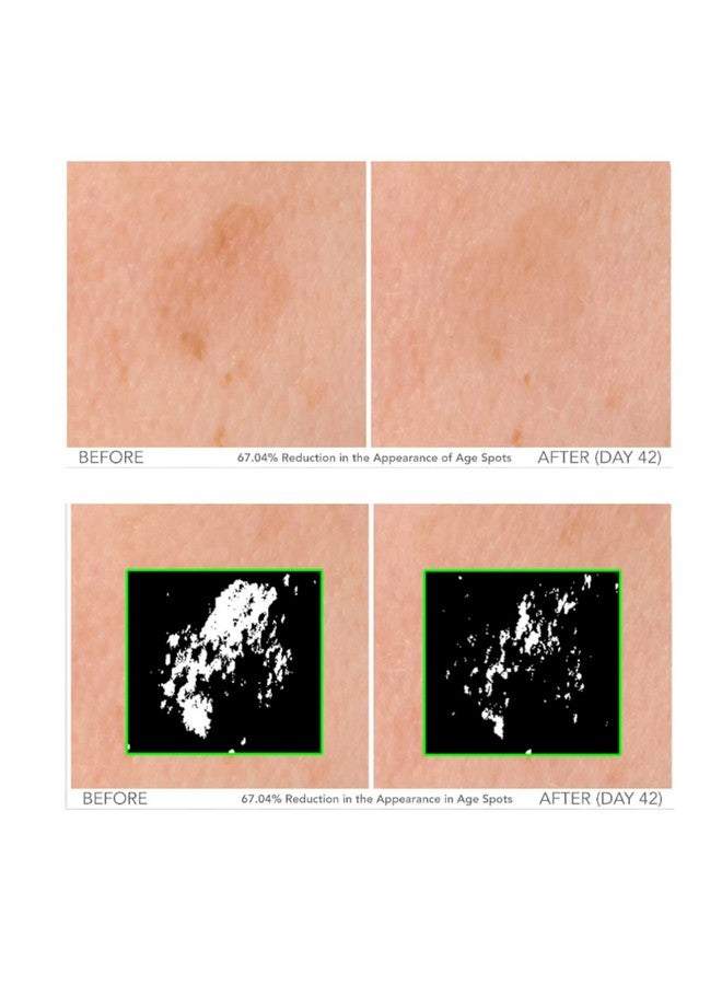 Serious Skincare Serious Beyond Facial Treatment Set Intensive Morning 1 Oz. And Evening 1 Oz. Serums Visibly Improves Fine Lines Wrinkles And Skin Texture On The Face And Neck - Image 3