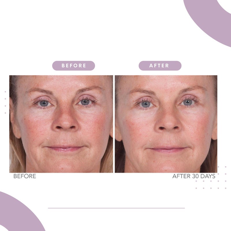 Serious Skincare Reverse Lift Firming Facial Serum, Visibly Firm, Tone & Tighten Skin, Hydrating Anti-Aging Peptides, Reduce Wrinkles, Sagging Face and Neck, Serious Skincare, 1 oz - Image 5