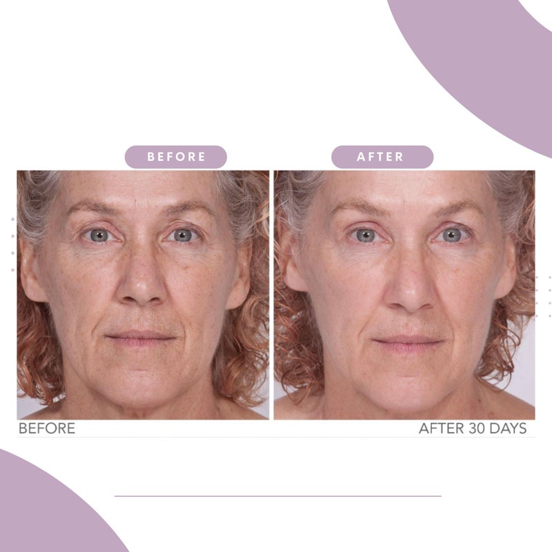 Serious Skincare Reverse Lift Firming Facial Serum, Visibly Firm, Tone & Tighten Skin, Hydrating Anti-Aging Peptides, Reduce Wrinkles, Sagging Face and Neck, Serious Skincare, 1 oz - Image 4