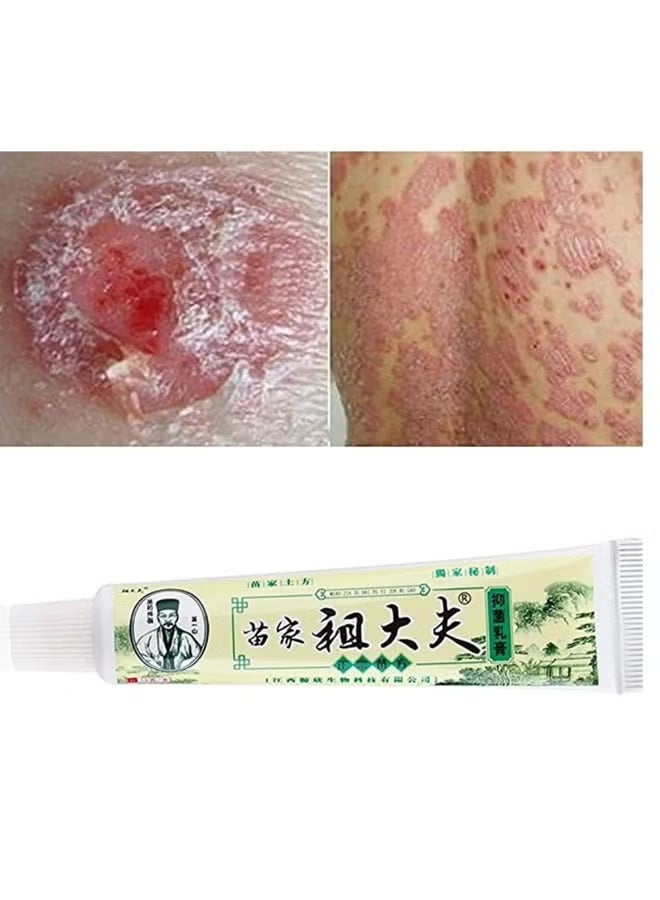 zudaifu Antibacterial Cream Skin Care Chinese Herbal Cream cream Rich in Herb Extract Essence Product Relief Pruritus Eczema Creams Dermatitis Psoriasis Ointment Skin - Image 2