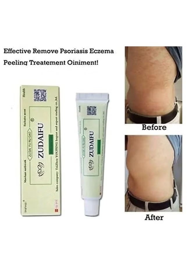 zudaifu Antibacterial Cream Skin Care Chinese Herbal Cream cream Rich in Herb Extract Essence Product Relief Pruritus Eczema Creams Dermatitis Psoriasis Ointment Skin - Image 5