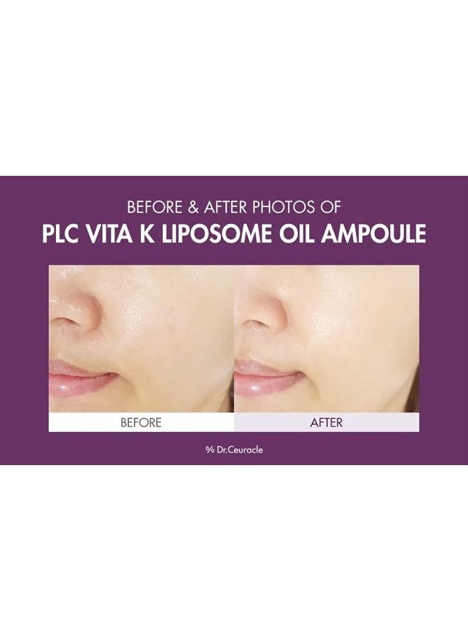 leegeehaam - PLC Vitamin K Liposome Oil AmpouleㅣSpecial Care for Toning, Glowing, Hydration, BrighteningㅣSkin-Friendly Water&Oil Layer FormulaㅣSerum for Dark AreaㅣDr.Ceuracle - Image 1