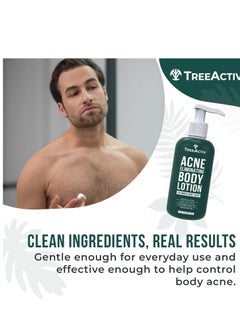 TreeActiv TreeActiv Acne Eliminating Body Lotion 8 fl oz | Clears Body, Back, Butt and Shoulder Acne | Anti-Acne Moisturizer | Prevents Future Breakouts | Cucumber Mint Scent  - Image 2