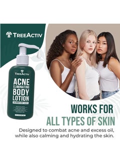 TreeActiv TreeActiv Acne Eliminating Body Lotion 8 fl oz | Clears Body, Back, Butt and Shoulder Acne | Anti-Acne Moisturizer | Prevents Future Breakouts | Cucumber Mint Scent  - Image 3