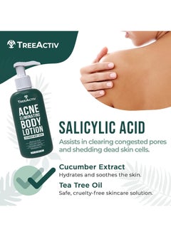 TreeActiv TreeActiv Acne Eliminating Body Lotion 8 fl oz | Clears Body, Back, Butt and Shoulder Acne | Anti-Acne Moisturizer | Prevents Future Breakouts | Cucumber Mint Scent  - Image 4