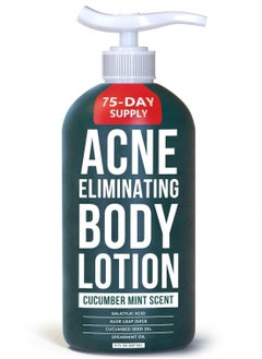 TreeActiv TreeActiv Acne Eliminating Body Lotion 8 fl oz | Clears Body, Back, Butt and Shoulder Acne | Anti-Acne Moisturizer | Prevents Future Breakouts | Cucumber Mint Scent  - Image 1