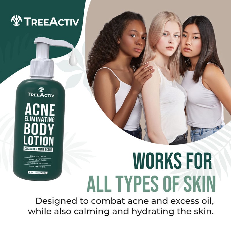 TreeActiv Acne Eliminating Body Lotion 8 fl oz | Clears Body, Back, Butt and Shoulder Acne | Anti-Acne Moisturizer | Prevents Future Breakouts | Cucumber Mint Scent - Image 3