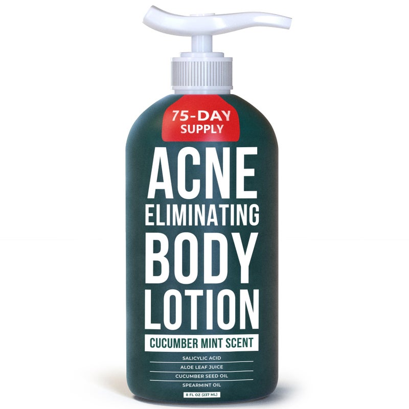 TreeActiv Acne Eliminating Body Lotion 8 fl oz | Clears Body, Back, Butt and Shoulder Acne | Anti-Acne Moisturizer | Prevents Future Breakouts | Cucumber Mint Scent - Image 1