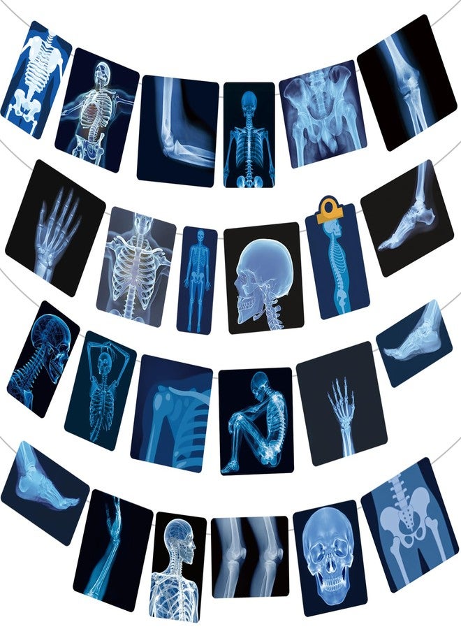 Yavxzvbw Radiology X Ray Doctor Party Decorations Banner Radiology Party Decorations X-ray Hanging Garland for Radiology Doctor Birthday Party X-Ray Medical Theme Nurse Graduations Decorations Supplies - Image 1