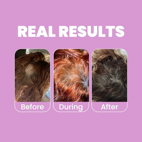 Anyeluz Onion Shampoo and Conditioner Set – Enriched with Onion Extract and Biotin, Cleanses and Reduces Oiliness, Strengthens and Revitalizes, Suitable for All Hair Types - Image 5