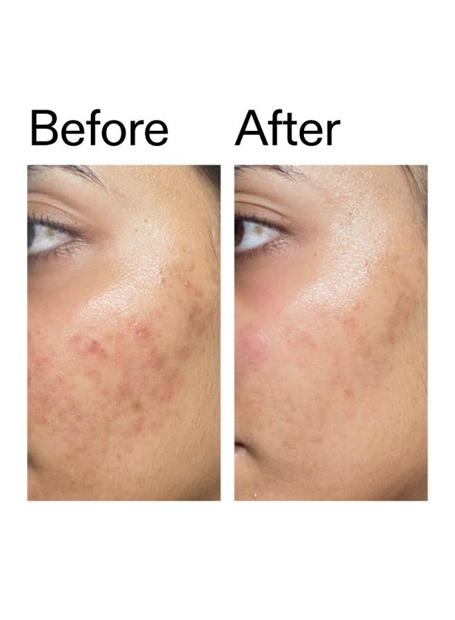 The INKEY List Ectoin Hydro-Barrier Serum 30ml - Image 2