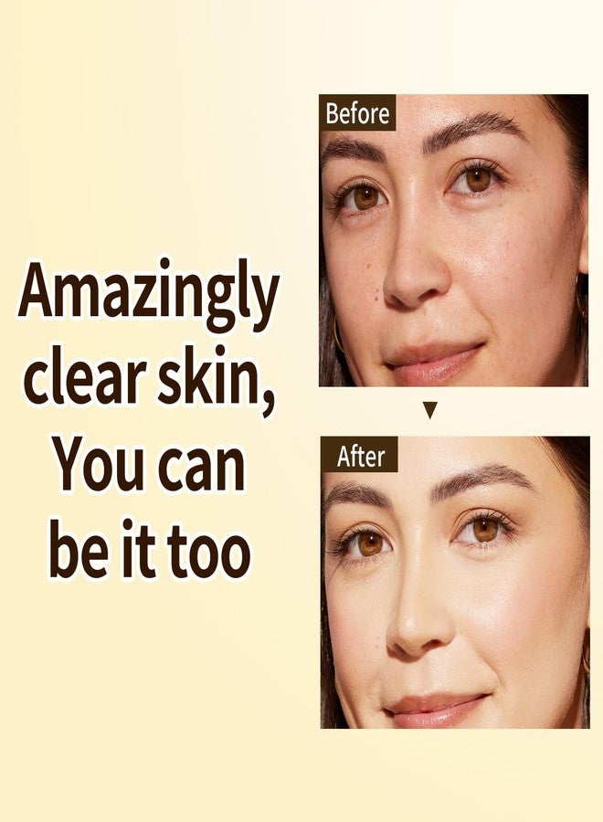 IREV Turmeric Vitamin C Face Serum For Women, Hydrating Serums For Face With Ginger For Dull Skin,Sun Damage, Fine Lines, For Plumper, Smoother Skin, Clarifying 30ml - Image 2