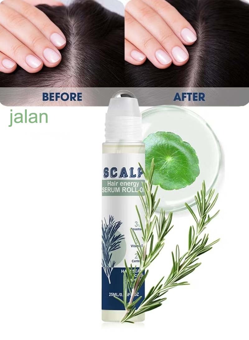 jalan Rosemary Hair Growth Roll-On Essence 25ml Anti-Hair Loss, Stimulates Hair Follicles, Thickens and Strengthens Hair Suitable for All Hair Types - Image 1