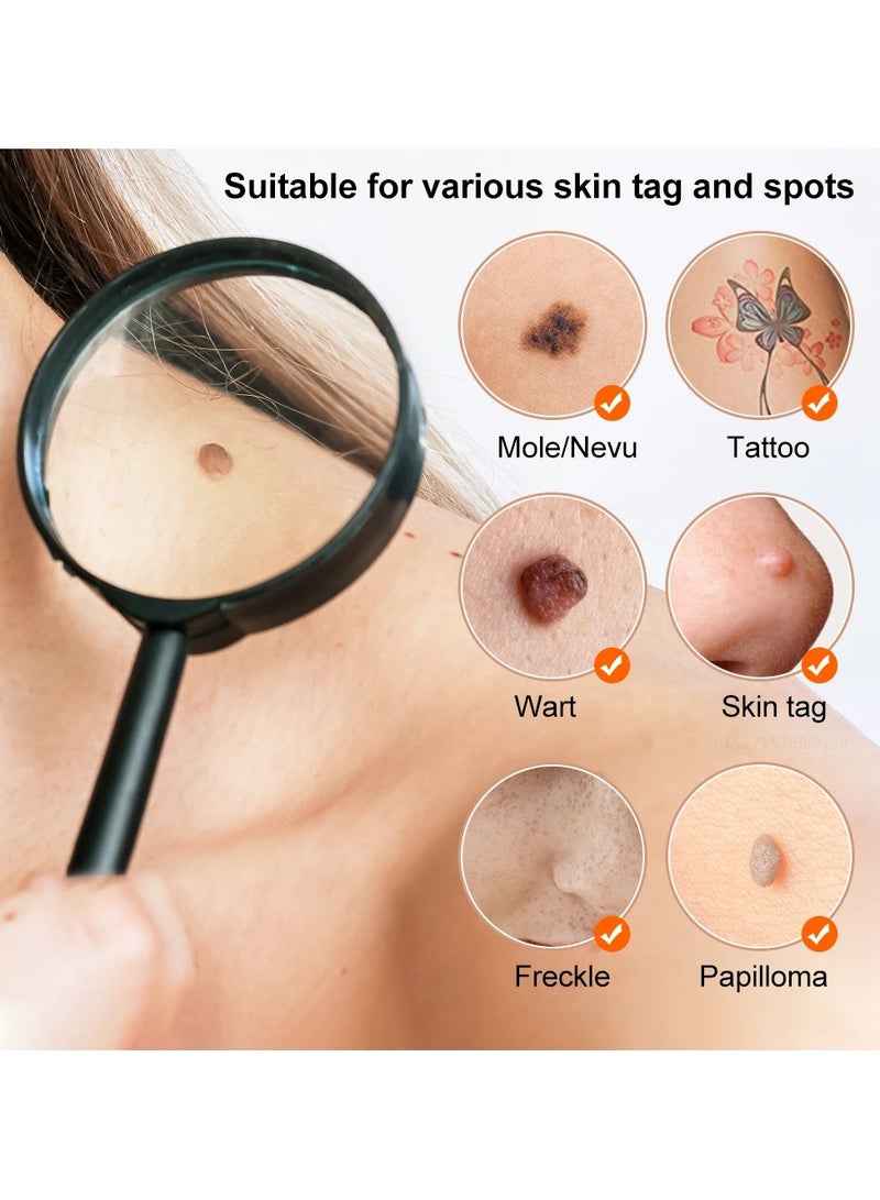 عام Laser plasma pen skin tag remover mole wart remover mole blackhead removal face body mole removal pen - Image 2