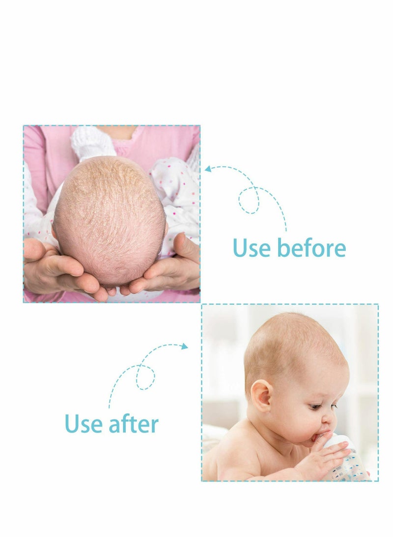Excefore Cradle Cap Brush and Comb,3 In 1 Design Cradle Cap Brush Safe Baby’s Scalp Brush with Soft Rubber Bristles, Help Gently Massage Care Scalp 2 Pcs - Image 3