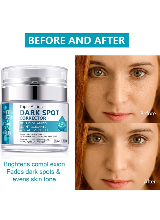 Elaimei - Dark Spot Corrector For Face And Body, Dark Spot Corrector Cream, Melasma Treatment, Hyperpigmentation Treatment, Freckle Remover With Tranexamic Acid, Niacinamide, Squalane And Vitamin E Serum - Image 1