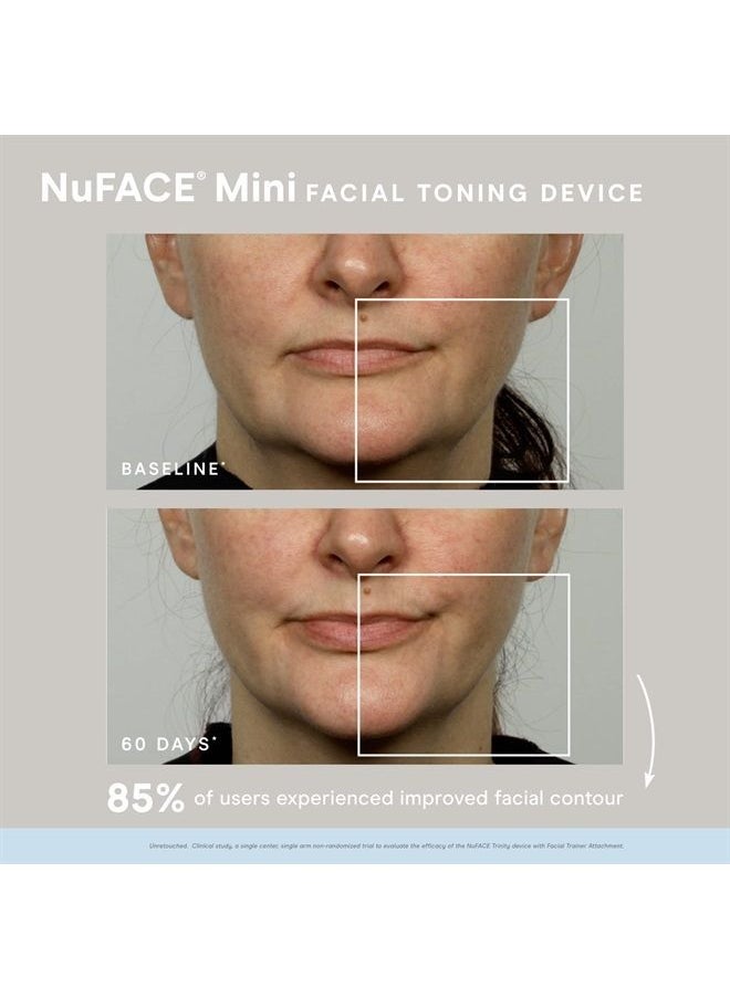 Nuface - Mini Starter Kit – Mini Facial Toning Device with Hydrating Leave-On Gel Primer, 2 Fl Oz - Image 1