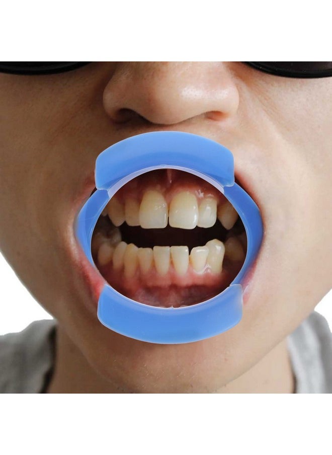 Healifty 2Pcs O Oral Watch Speak Orthodontics Tool Lipless Shape For Mouthguard Teeth White Orthodontic Opening Game Fun Ya Opener Blue Block Device Mouth Intraoral Autoclavable Cheek  - Image 2