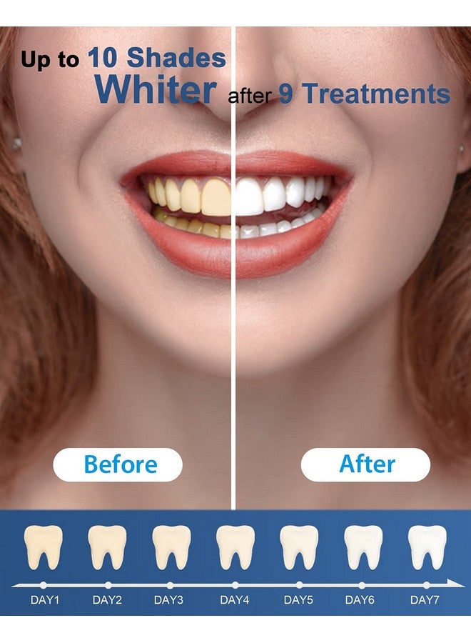 MySmile Teeth Whitening Gel Refills Pack, 6 Non-Sensitive Teeth Whitening Gel Pen, Teeth Whitener Dental Grade Tooth Whitening Gel for Tray, 10 min Fast Result Whitening - Image 5