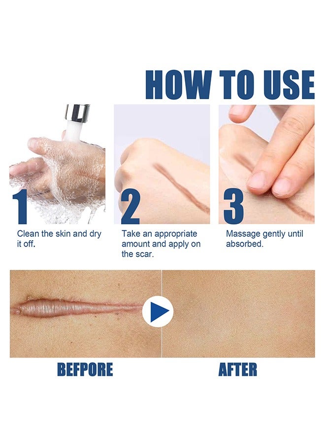 EELHOE Scar Cream-Quick Repair Scar Cream for Acne/Injuries/Burns for All Skin Types (15g) - Image 4