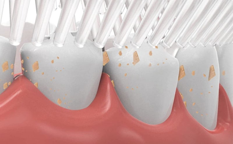 Plenteous فرشاة أسنان على شكل U للأطفال لتنظيف الفم بتصميم خاص للأطفال الصغار والأطفال (متعددة الألوان) (1) - Image 5