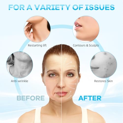 MAYCREATE® Double Chin Reducer Face Lifting Mask Device Cool Touch V-Line Jawline Shaper Breathable Double Chin Lift Mask Strap Belt for Sleeping Anti-Wrinkle Full-Face Lifting - Image 4