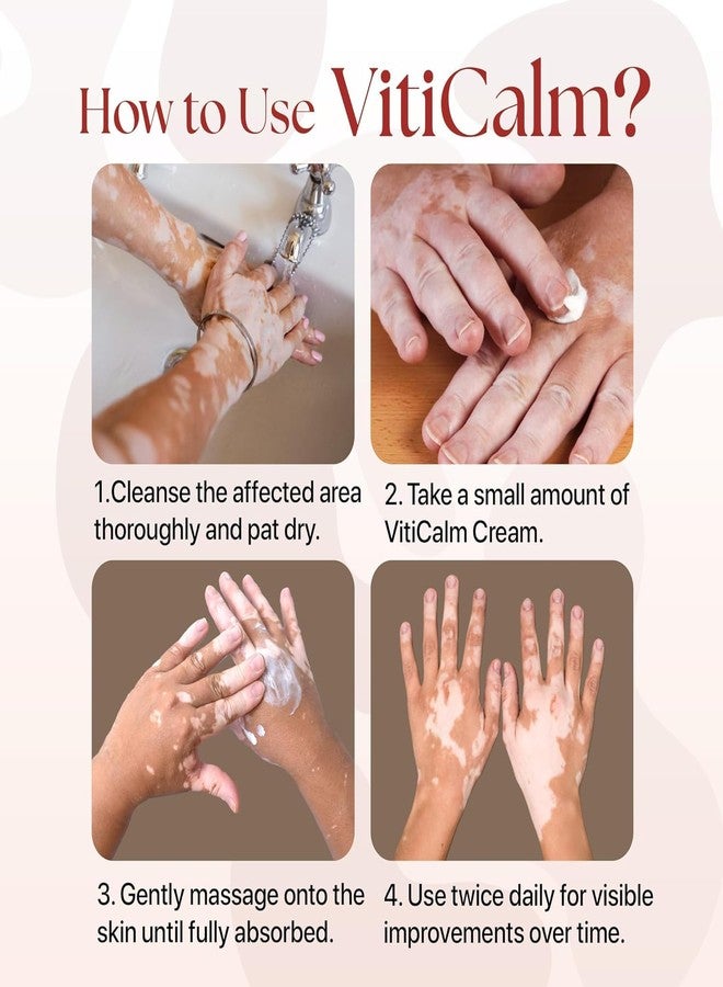 SiyaAyurveda كريم فيتيكالم للبهاق | يُعيد تصبغ البقع البيضاء، ويُخفف من أعراض البهاق، ويُساعد على استعادة لون البشرة الطبيعي | د. ميغا تشاتورفيدي | كريم 100 مل - Image 3