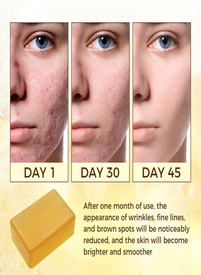 OUKEYA Dark Spot Remover Soap Bars, Turmeric Soap Bar, for Body & Face with Vitamin C, E, Retinol, Collagen, Shea Butter, Infused with Hyaluronic Acid, Soap for Men, Women - Image 3