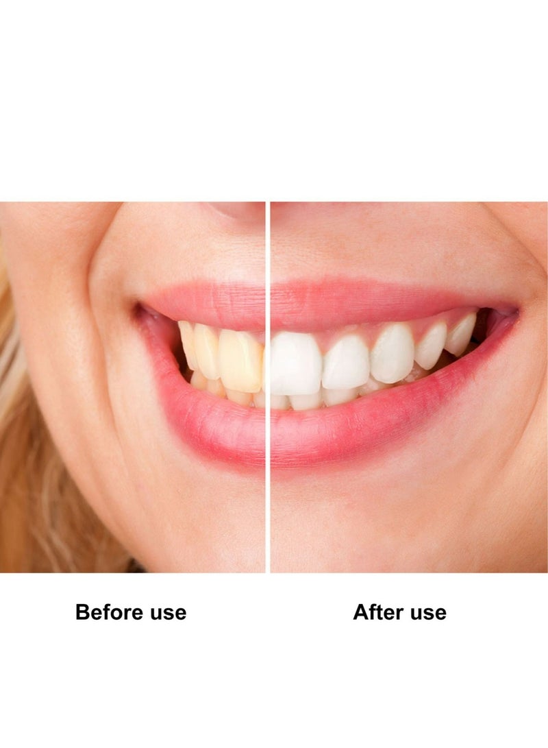 5D 14 Pieces Dental White Advanced Teeth Whitening Stickers Teeth Whitener Strips Oral Hygiene Tool - Image 5