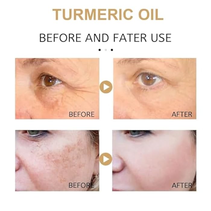 CROOT 2 Pack Turmeric Oil, Natural Turmeric Oil Serum for Face,Skin Care Moisturizing Serum(30ml) - Image 2