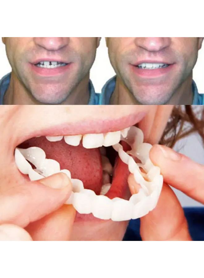 2 Pairs Realistic Dental Veneers Upper Lower Teeth Whitening Durable Easy Apply - Image 5