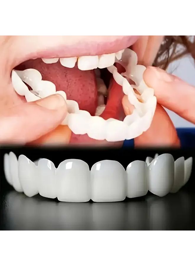 2 Pairs Realistic Dental Veneers Upper Lower Teeth Whitening Durable Easy Apply - Image 1