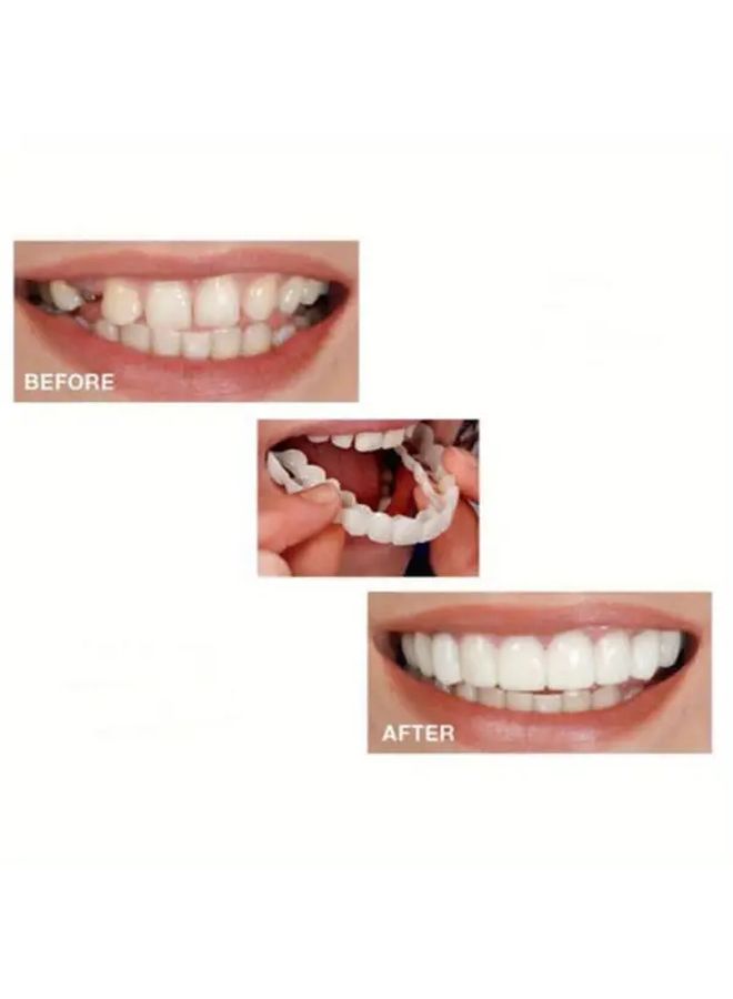 2 Pairs Realistic Dental Veneers Upper Lower Teeth Whitening Durable Easy Apply - Image 4