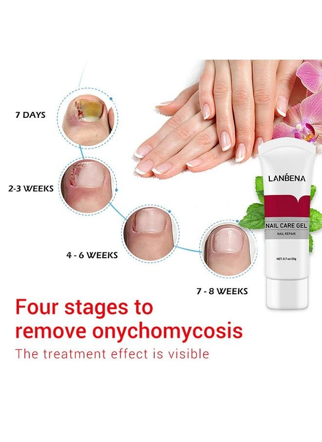 LANBENA Nail Care Gel - Nail Repair - Nail Repair Cream To Restore The Appearance Of Discolored Or Damaged Nails - 20G  - Image 4