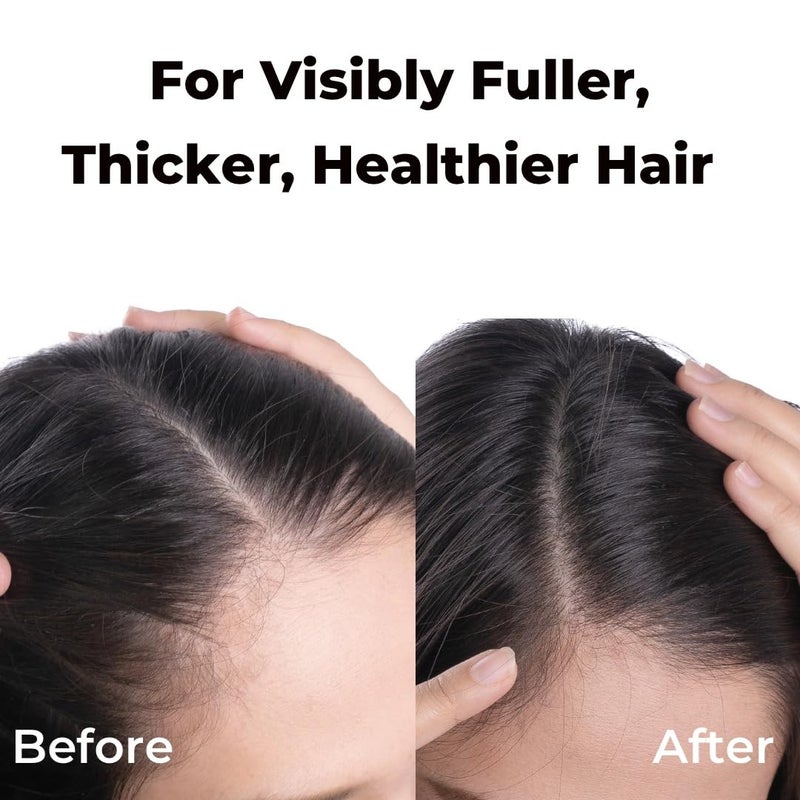 Brillare Professional Hair Fall Control Shampoo Natural Anti Hair Fall Hair Growth Shampoo with Soyabean Vital Plant Extracts for Better Hair Holding 300 ml - Image 4