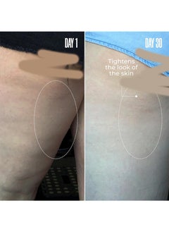 KOEC B-TIGHT Cellulite Removal Cream - Lift and Firm Booty Mask,Anti Cellulite Skin Firming Treatment for Butt and Thighs,Lifts and Firms,Reduces The Appearance Of Cellulite 3.38 fl.oz./100ml  - Image 5