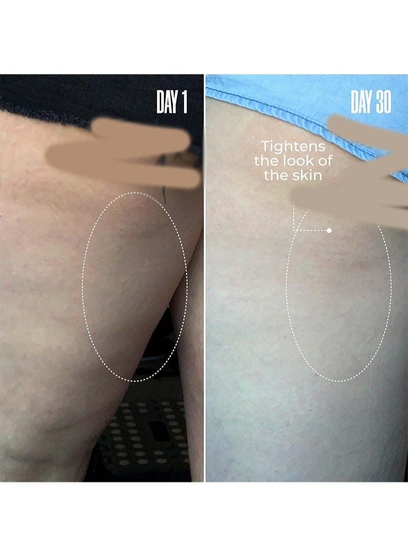 ك أو إي سي كريم إزالة السيلوليت من بي-تايت - قناع رفع وشد المؤخرة، علاج مضاد للسيلوليت لشد البشرة للأرداف والفخذين، يرفع ويشد، يقلل من ظهور السيلوليت 100 مل/3.38 أونصة سائلة - Image 5