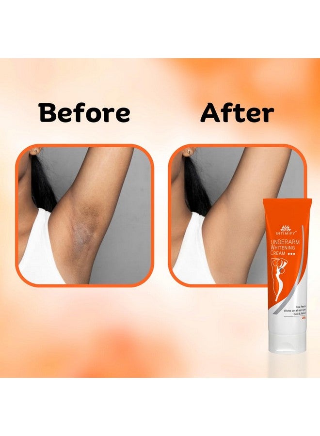 INTIMIFY كريم تفتيح الإبطين INTIMIFY للنساء، كريم تفتيح الإبطين طبيعي مع حمض الكوجيك وفيتامين B3 20 جرام - Image 2