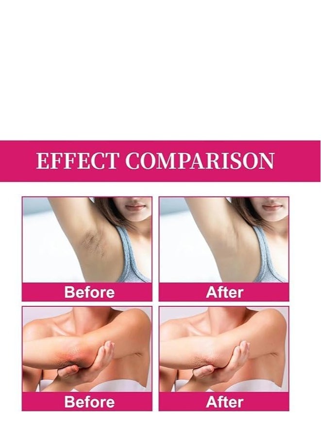 KOJIC ACID - Kojic Acid Skin Lightening Cream, Underarm Cream, Intimate Area Dark Spot Remover, for Body, Underarms, Armpit, Knees, Legs and Inner Thigh Cream for Acanthosis Nigricans, Non-Greasy - Image 1