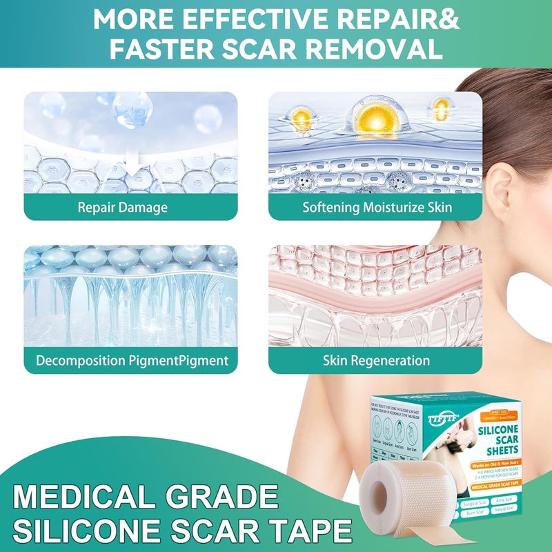 TTFTTF Silicone Scar Tape Silicone Scar Sheets16X 160 Roll4M Reusable Medical Grade Silicone Tape for Scars CSection Keloid Acne Tummy Tuck Surgical Scars Light - Image 3