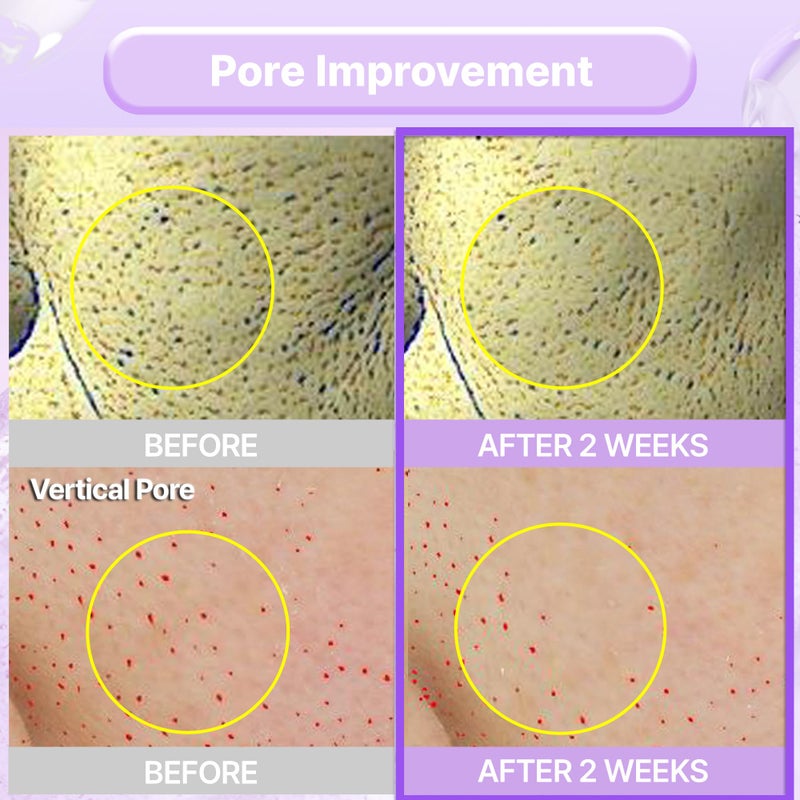 BIOHEAL BOH كريم إعادة تشكيل الكولاجين BIOHEAL BOH Probiodermâ„¢ 1.69 أونصة سائلة (50 مل) | كريم شد المسام مع 150,000 كبسولة كولاجين لثبات ونعومة البشرة | مرطب خفيف لبشرة خالية من العيوب - Image 5