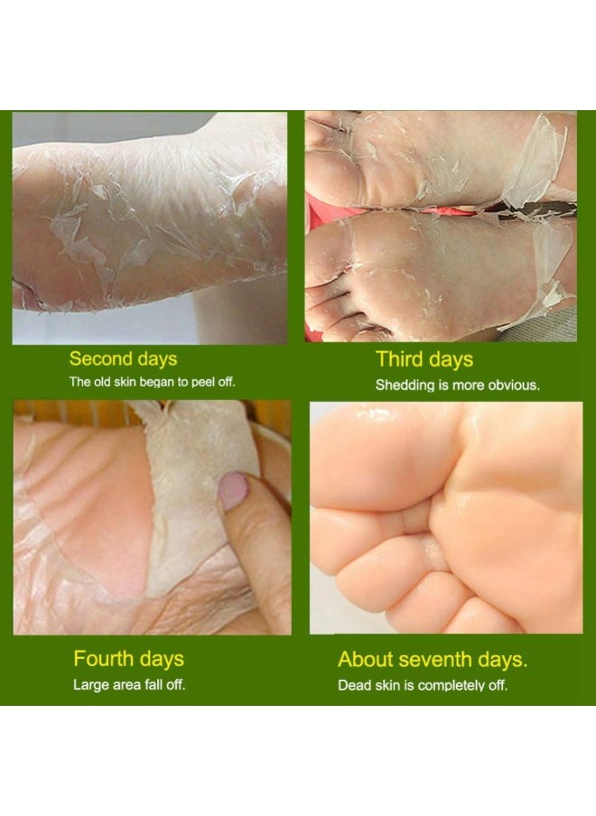 klarako - Yiitay Foot Peeling Mask Exfoliating Foot Mask Feet Mask Peel Off Foot Mask Socks for Remove Dead Skin, Foot Moisturizing Mask for Soft Feet, Exfoliating Booties 1 Pair - Image 1