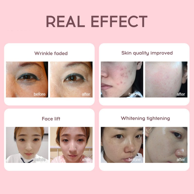 Skin Rejuvenation Instrument RF/EMS Beauty Instrument Cleansing Brightening Phototherapy Tender Skin Warm Lifting Eye Care - Image 5