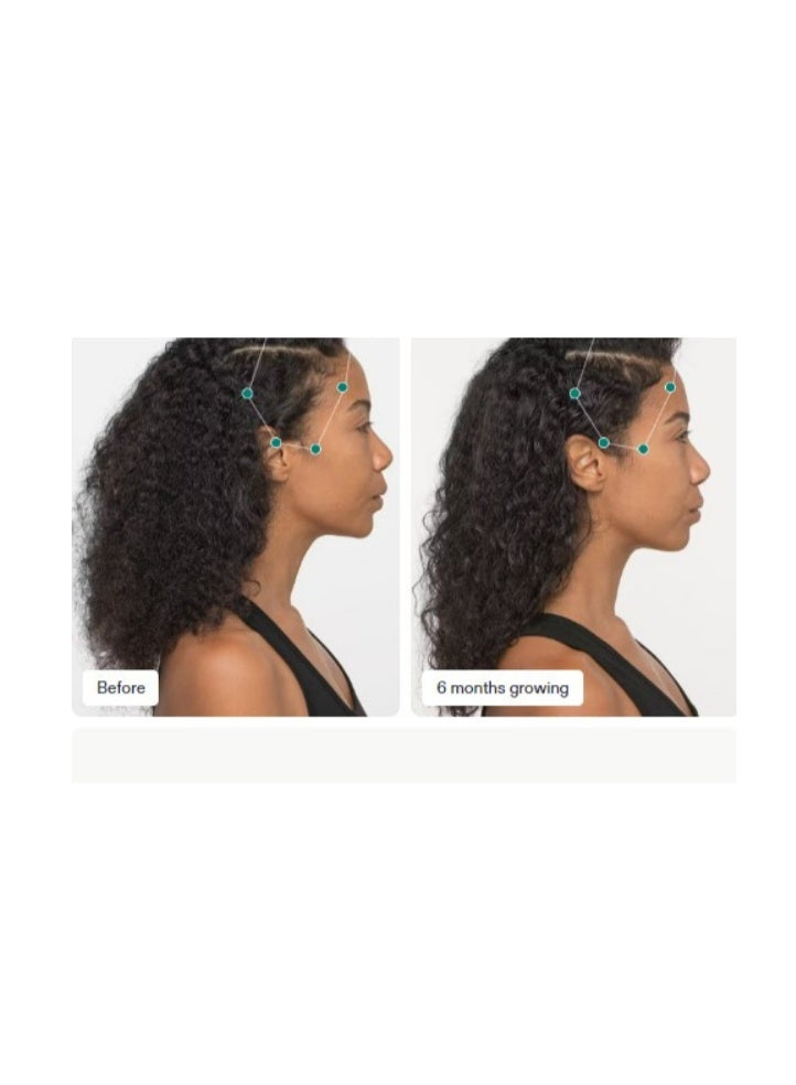 Nutrafol, a dietary supplement for women's hair growth, 120 capsules - Image 3