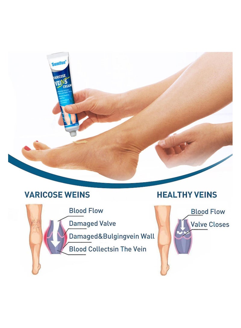 Sumifun Varicose Veins Cream, 20gm - Image 4