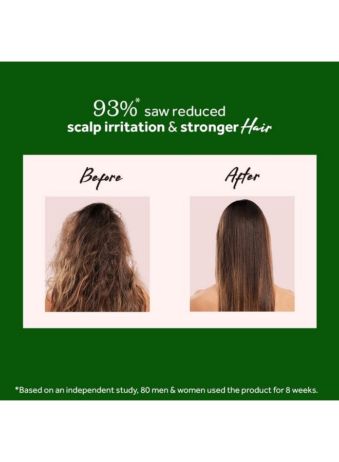 Atulya Neem & Sage Hair Mask for Controlling Dandruff & White Flakes | Anti-Dandruff Hair Mask | Hair Mask for Reducing Hair Fall | Paraben, Sulphate & Silicone Free | All Hair Types | 200gm - Image 5