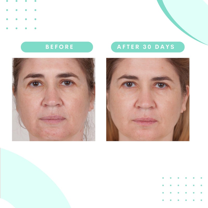 Serious Skincare Glycolic Gommage Extreme Renewal Facial Mask for Radiant Skin - Glycolic Acid - Micro Exfoliation Facial Treatment Mask - Decongest Clogged Pores - 4.5 oz (1Pack) - Image 4