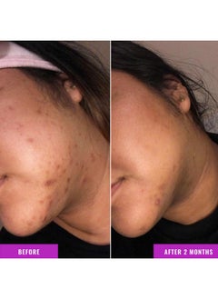 GOOD MOLECULES Good Molecules Discoloration Correcting Serum - Tranexamic Acid and Niacinamide for Dark Spots, Sun Damage, and Age Spots - Skincare Face  - Image 4